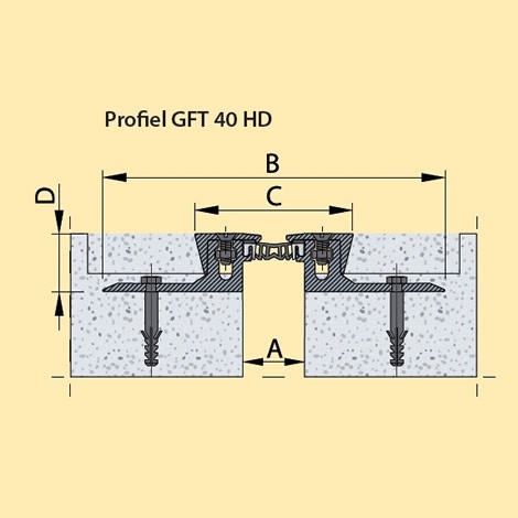 GFT-serie